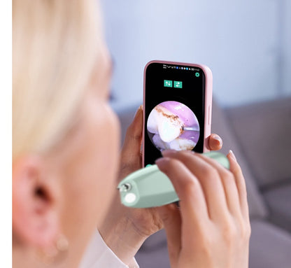 Sarah Express High-Definition Visual Dental Cleaner with LED Camera - Professional Plaque Remover