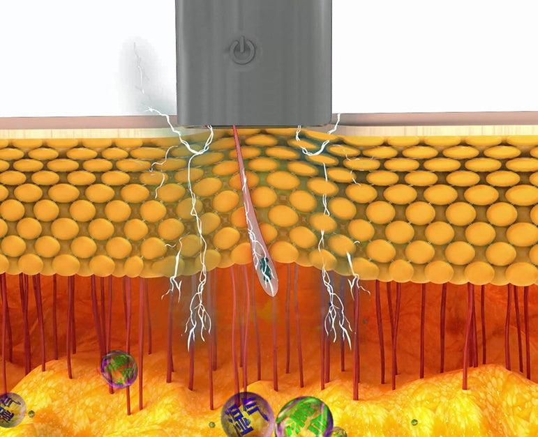 Sarah Express Electric Cupping Therapy Massager with EMS Pulse Technology